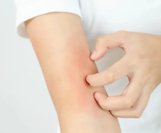 Jakie są najczęstsze przyczyny zaostrzeń AZS?