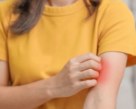 Jak unikać drapania i radzić sobie ze swędzeniem przy AZS?